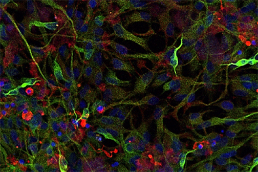 Αmyloid β peptide–mediated damage